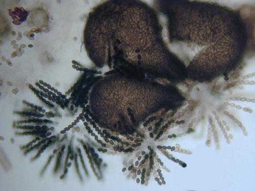 Представитель Семейства Sordariaceae